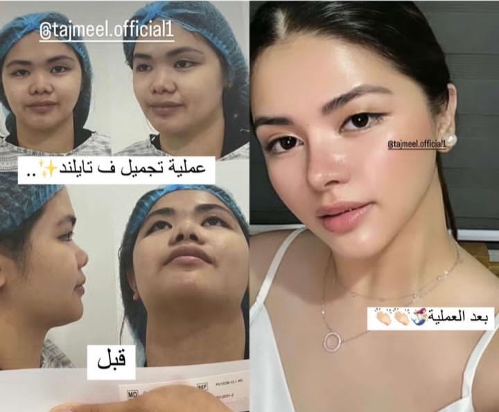 Screenshot_٢٠٢٣٠٩٠٢-١٣٣٦٥٠_Instagram.jpg